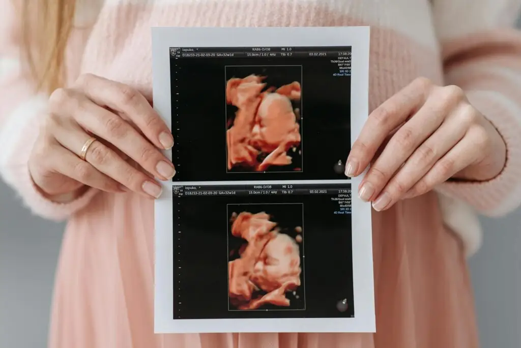 a imagem mostra uma mulher com o resultado de um ultrassom
